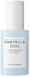 SKIN1004 Madagascar Centella Hyalu-cica Blue Serum 30ml (8809576261059)