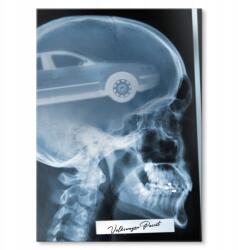 SteelPoster Fém röntgen poszter Vw Passat S (plakat dekoracyjny, metalowa tablica, szyld)