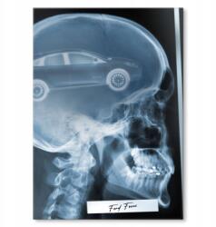 SteelPoster Fém poszter Röntgen Ford Focus III Tábla Tepsi 22 x 31 cm +ajándék (plakat dekoracyjny, metalowa tablica, szyld)