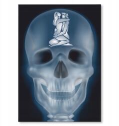 SteelPoster Fém poszter xray love Tábla Tepsi 42 x 59, 4 cm +ajándék (plakat dekoracyjny, metalowa tablica, szyld)
