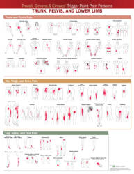 Wolters Kluwer Health Travell, Simons & Simons' Trigger Point Pain Patterns Wall Chart | Anatomica Chart Company
