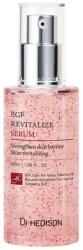 Dr.Hedison , Dr. Hedison, EGF, Revitalizálás, Szérum, 50 ml