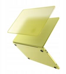 Spigen Airskin Macbook Neo 13 2026 Frost Citrus (ACS11544)