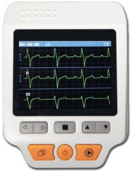 Hordozható kisméretű EKG készülék
