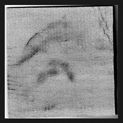 Pretty Hurts Pretty Hurts