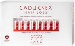 CADU-CREX súlyos stádiumú hajhullás elleni kezelés, férfiaknak, 20 ampulla