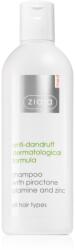 Ziaja Med Anti-Dandruff Dermatological Formula sampon anti-matreata 300 ml