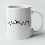  Rottweiler heartbeat bögre (roti_heartbeat_bogre)