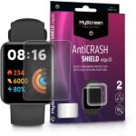 MyScreen Protector AntiCrash Shield Edge3D Xiaomi Redmi Watch 2 Lite ütésálló képernyővédő fólia 2db/csomag (LA-2165) (LA-2165) (LA-2165)