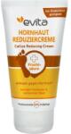 Evita Cremă de picioare pentru îndepărtarea pielii aspre - Evita Callus Reducing Cream 75 ml