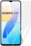 Screenshield HONOR X8 5G kijelzővédő fólia (HUA-HONX85G-D)