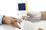  MicroINR véralvadásmérő készülék INR mérő PrivátDoktor alkalmazással kompatibilis
