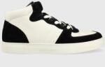 Emporio Armani sneakers X4Z119 XN777 N814 culoarea negru, X4Z119 XN777 N814 PPYX-OBM09Y_99X