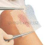  GRASSOLIND 10 x 10 cm kenőcstüll 10 db