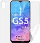 Screenshield GIGASET GS5 Lite teljes készülékre (GST-GS5LT-B)