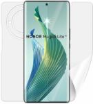 Screenshield Honor Magic 5 lite 5G teljes készülékre (HUA-HONM5LT5G-B)