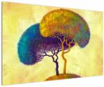 Mivali Tablou - Copaci în deal, dintr-o bucată 120x80 cm (V022537V12080)