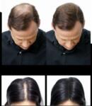  Csomag x 3 Hajépítő szálak, Ritka hajszálak, hajhiány miatt, Sevi (Pach3Sev02)