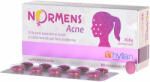 Hyllan Pharma Normens Acne, 30 comprimate, Hyllan