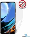 Screenshield Anti-Bacteria XIAOMI Redmi 9T kijelzővédő fólia (XIA-REDMI9TAB-D)