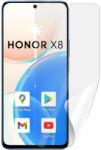 Screenshield HONOR X8 kijelzővédő fólia (HUA-HONX8-D)