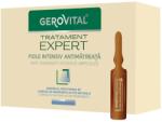 Gerovital Treatment Expert intenzíven ápoló ampullák, korpásodás ellen, 10 x 10 ml