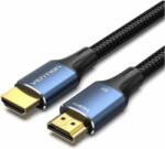 Vention ALGLG HDMI 2.1 - HDMI 2.1 Kábel 1.5m - Fekete (ALGLG)