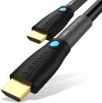 Vention AAMBT HDMI 1.4 - HDMI 1.4 Kábel 15m - Fekete (AAMBN)