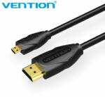 Ventiune Cablu Vention Cablu Micro HDMI2.0 1.5M Negru - VAA-D03-B150 (VAA-D03-B150)