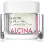 ALCINA For Sensitive Skin krém a kipirosodás csökkentésére 50 ml