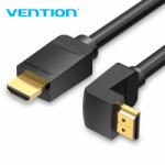 Vention AAQBG