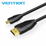 Vention VAA-D03-B150