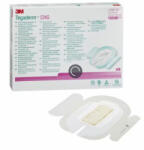  Tegaderm CHG antimikrobiális kanülrögzítő 10 cm x 15, 5 cm 1659R (25 db)