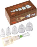 Rimba - set ventuze masaj cu vacuum - 6 piese