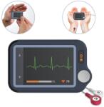 Viatom Pulsebit / Személyi EKG nyomkövető egészségmonitor
