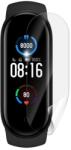 SUNSHINE 6 db Hidrogél fólia Mi Band 5 STANDARD MINŐSÉG
