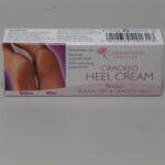 Carnation Carnation sarokbőr simító krém 50 g - delfinbuvar