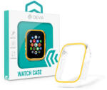 DEVIA Apple Watch szilikon védőtok - Devia Luminous Series Shockproof Case For iWatch - 41 mm - arany (ST359637)