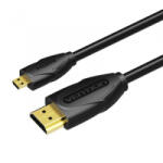 Vention HDMI - Micro HDMI kábel 1m fekete (VAA-D03-B100) (VAA-D03-B100)