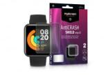 MyScreen Protector AntiCrash Shield Edge3D Xiaomi Mi Watch Lite ütésálló képernyővédő fólia 2db/csomag (LA-1921) (LA-1921)