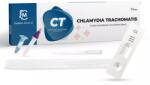  Chlamydia trachomatis (Ct) antigén gyorsteszt nőknek és férfiaknak (1 db/doboz)