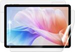 Screenshield DOOGEE T30S védőfólia (DOO-T30S-B)