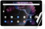 Screenshield IGET Blackview TAB G16 védőfólia (IGT-BVTABG16-D)