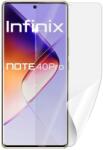 Screenshield INFINIX Note 40 PRO védőfólia (INF-NO40PR-D)