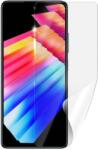 Screenshield INFINIX Hot 30 védőfólia - kijelzőre (INF-HOT30-D)