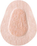  Tencuieli Viscoplast, Opti-plast Junior, 62 mm x 50 mm, 10 bucăți