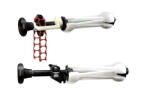 Manfrotto Expan csörlő szett piros lánccal