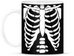 printfashion Csontváz - Bögre - Fekete (14450347)