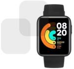 FONIX 2 x Xiaomi Mi Watch Lite kompatibilis fólia készlet, InvisiFlex Full Glue, Regenerálható szilikon hidrogél, ütés- és törésgátló, SlimLine NanoShield, átlátszó (FNX-F-Folie-silicon-Xiaomi-Mi-Watch-Lite