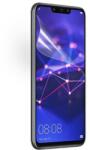  Kijelzővédő Fólia Huawei P9 Plus